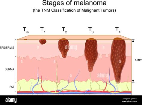 malignomausschluss|Diagnose von malignen Tumoren